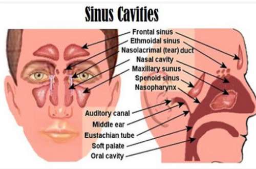 Sinus Infections Caused By Fungus