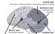 All about anoxic brain injury, the injury suffered by Anne Heche?