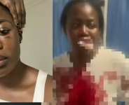Nana Akua Addo hospitalised after alleged assault by husband