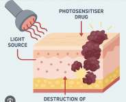 Photodynamic Therapy: A Game-Changer in Combating Bacterial Infections and Cancer in Ghana