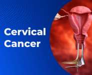 Cervical Cancer: Meeting Who Goals In Ghana-Are We Making Progress?