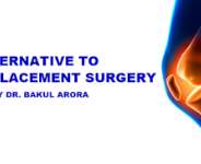 Unique Alternative To Knee Replacement Surgery