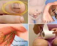 Deadly Cancer Signs Most Women Reject