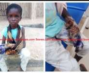 Boy 5, Who Had His Hand Amputated Receives 5k Support