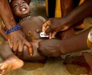 FGM, A Devastating Women Right Violation