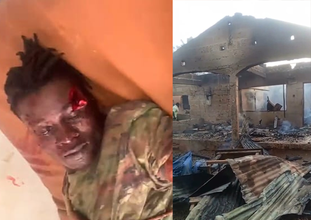 The victim at the hospital, The family house allegedly set ablaze by some landguards