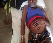 Witch hunts: Thomas Eze Needs Justice in Ebonyi State