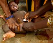 FGM, A Devastating Women Right Violation