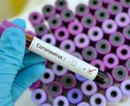 Coronavirus: Fearless Virus Field Marshall, Locks Down The World With Ease