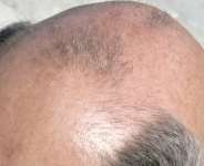 Calling a man ‘bald’ is sexual harassment – Court rules