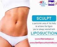 liposuction in Delhi