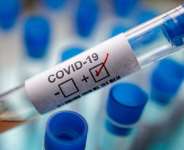 COVID – 19: Govt Alone Can’t Fight The Pandemic – World Vision National Director