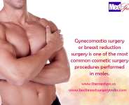 gynecomastia