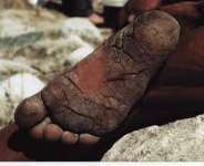 The Man Without Shoes