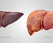 When the Keeper Falls Silent: How Liver Disease Can Hide in Plain Sight