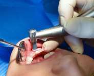 A child in a dentists chair