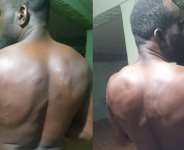 Sandema carpenter hospitalized after alleged military brutality for calling on govt to fix Chuchuliga-Sandema-Wiesi road