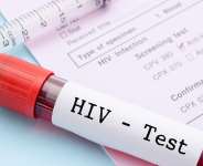 HIV/AIDS