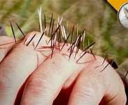 Dancing With Porcupines Without Getting Hurt Part 1