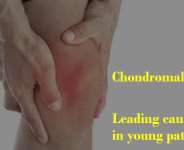 Chondro-malacia Patella Most common cause of knee pain in young individuals.