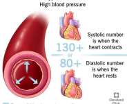 I’m Not Sick — Why Should I Check My Blood Pressure?