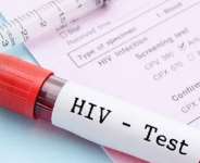 Three HIV infections recorded daily in Western Region — Ghana AIDS Commission