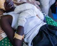 Faouzi Abdulbagi Mahammat Anour, 18, was taken to Chad for treatment after a drone attack while grazing livestock across the border in Sudan. By Joris Bolomey (AFP)