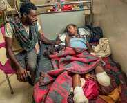 Iyerusalem, 10, lost a leg during bombardments in the conflict.  By - (AFP)