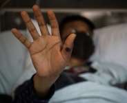 Mpox causes fever, muscular aches and large boil-like skin lesions and can be deadly in some cases. By Glody MURHABAZI (AFP/File)