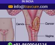 Cervical Cancer