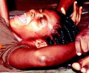 PAINFUL EXPERIENCE