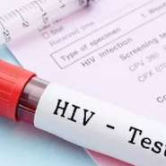 1,300 reactive HIV tests during security recruitment not confirmed diagnoses — AIDS Commission