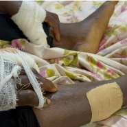 Kenyasi man allegedly attacked by prison officers and inmates over yam theft claim