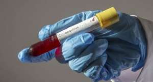 Covid-19: Quarantined Togolese Not Tested Positive – KMA