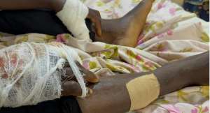 Kenyasi man allegedly attacked by prison officers and inmates over yam theft claim