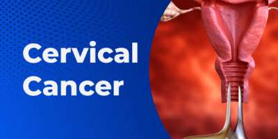 Cervical cancer, how do we prevent it?