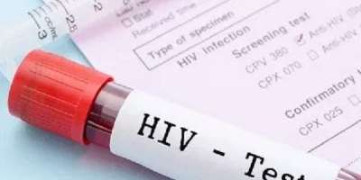 Bono Region records alarming 1,145 new HIV infections from January to May 2026