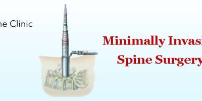 Minimally Invasive Spine Surgery