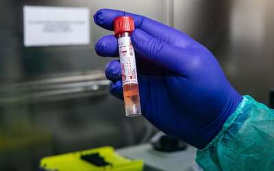 Coronavirus: Doctor At LEKMA Hospital Tests Positive