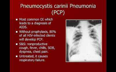 Planned Pneumocystis Carinii-Pneumonia Mass Disease