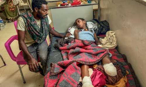 Iyerusalem, 10, lost a leg during bombardments in the conflict.  By - (AFP)