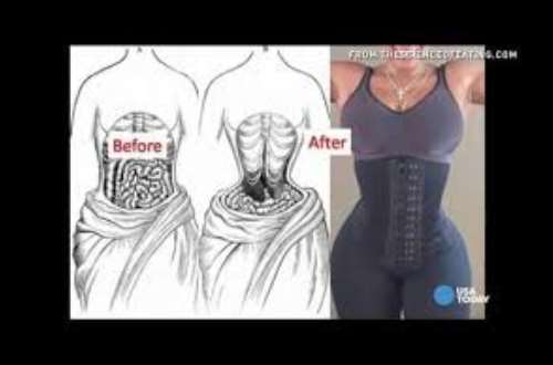 What is the difference between a corset and a waist trainer?