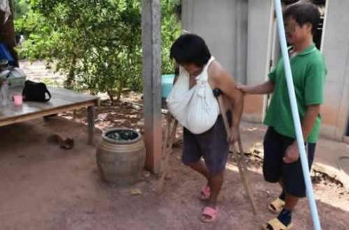 12-year-old girl in Palawan suffers from overgrown breasts that