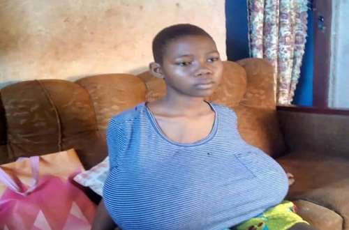 Health problems of having large breasts - DNB Stories Africa