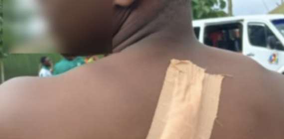 Two Christ the KingSHS students injured in machete attack by suspected gang