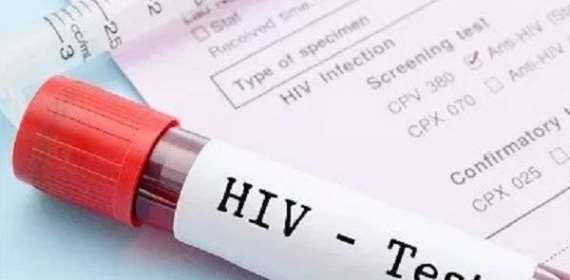 Bono Region records alarming 1,145 new HIV infections from January to May 20