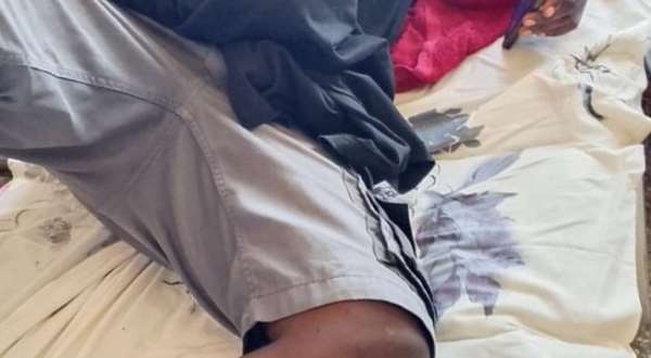 Army recruit loses hand during the clash