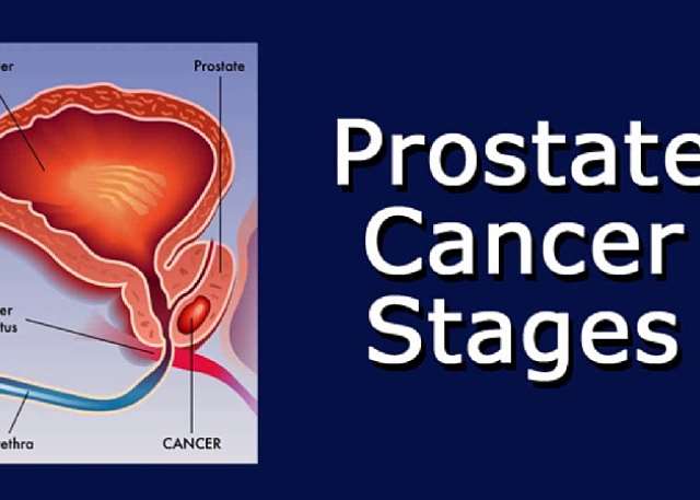 prostate cancer stage 1