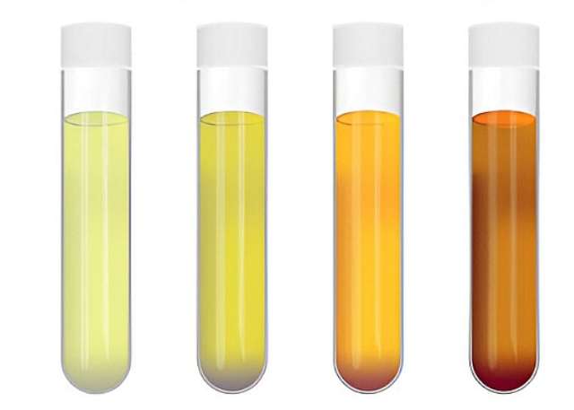 Why Pee (Urine) Changes Colour: Is It Healthy?