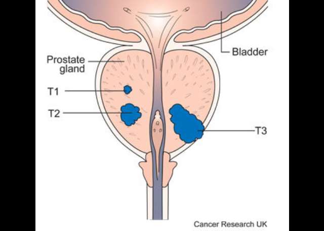 Doing Prostate Massage My Research on why Some Men opt for Anal